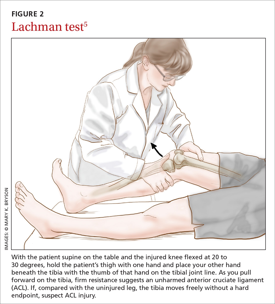 ACL Injury How Do The Physical Examination Tests Compare MDedge