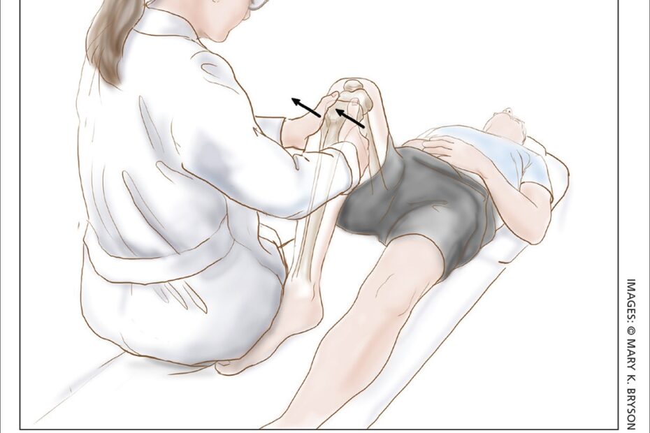 ACL Injury How Do The Physical Examination Tests Compare MDedge
