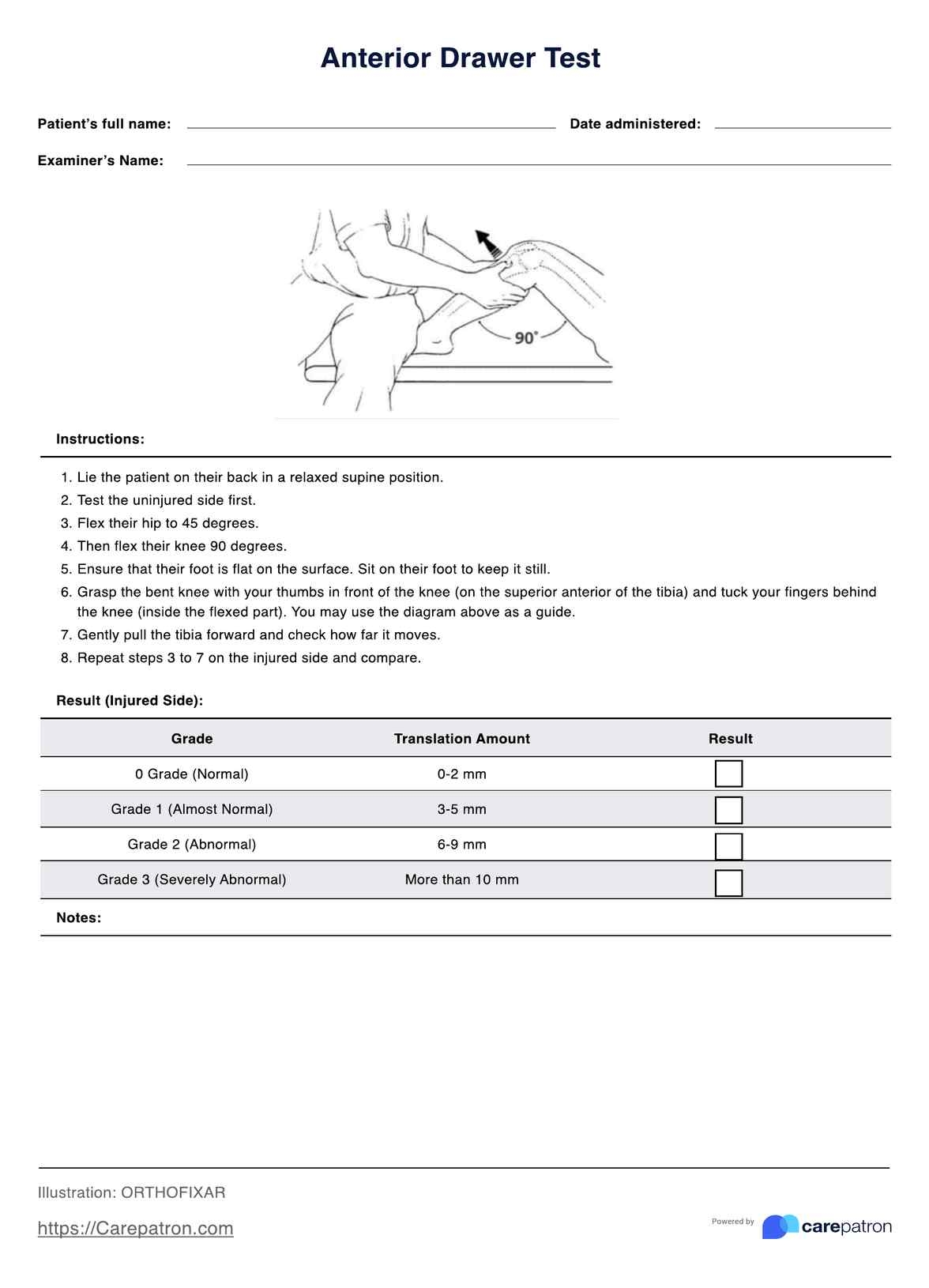 anterior drawer sign test