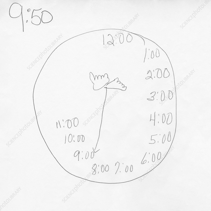 Clock Drawn By A Patient With Alzheimer s Disease Stock Image C057 2519 Science Photo Library