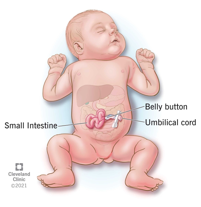 Gastroschisis Causes Symptoms Treatments