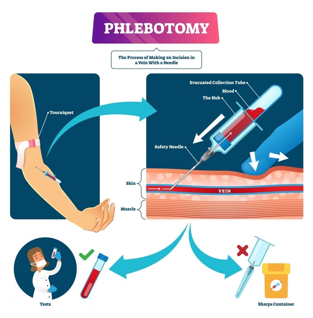 Master s Guide To Venipuncture Pro Tips For Performing Venipuncture Unitek College